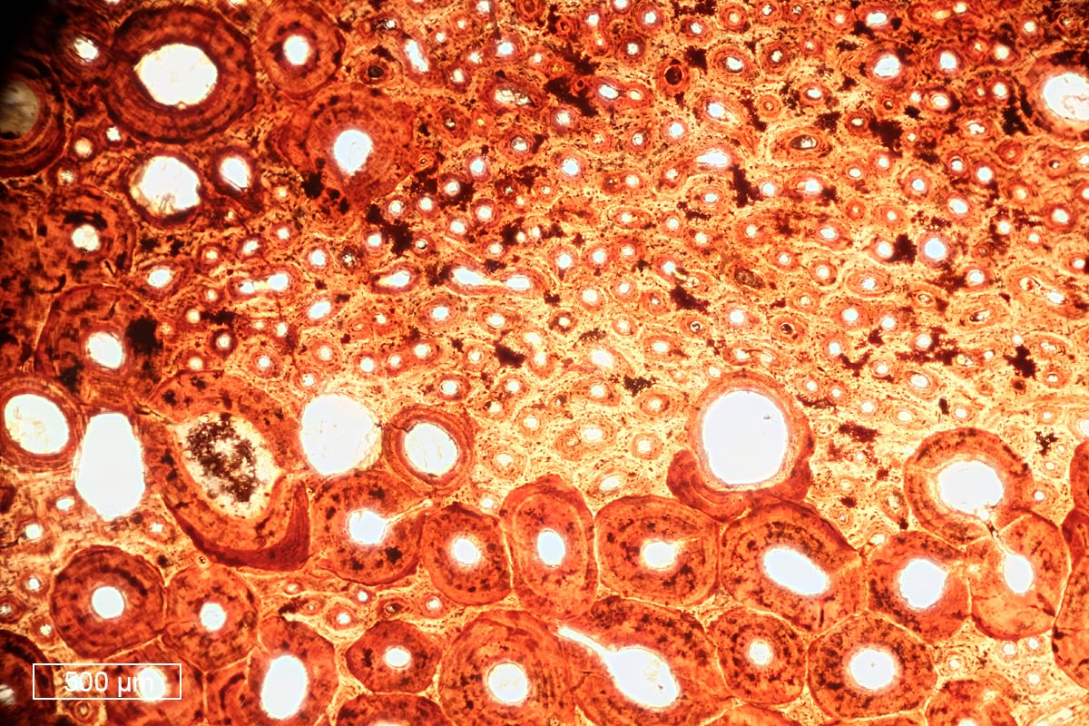 2025-08-15_fragments dos en lame mince (10).jpeg